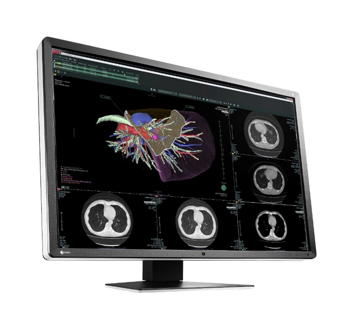 Cutting-edge Medical Monitors - RadiForce
