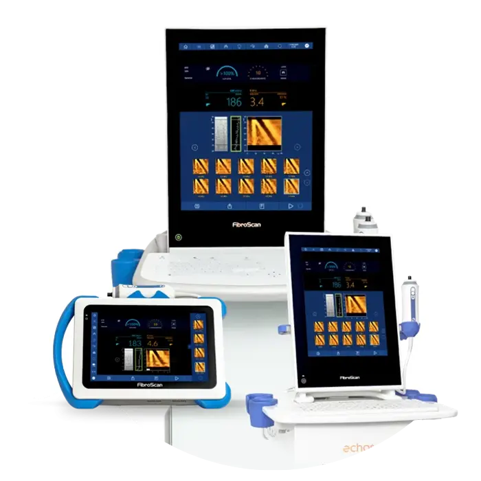 FibroScan