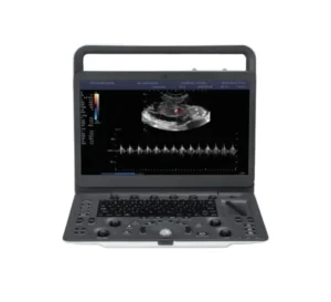 Portable Ultrasound E3V
